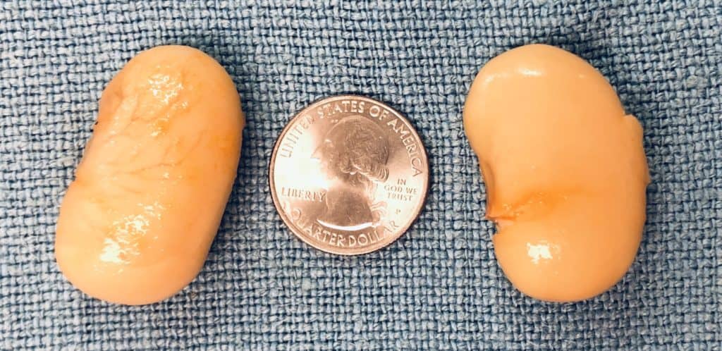 What Are The Largest Beans For Eating?